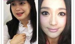 爆料女星削骨视频大全最新,女星削骨手术视频大盘点