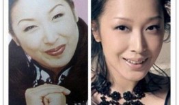 爆料女星削骨视频大全最新,女星削骨手术视频大盘点